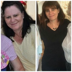 Banting diet weight loss success story